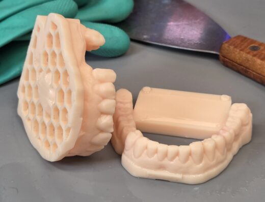 Modèles dentaires imprimés en 3D avec structure alvéolaire sur un plan de travail.